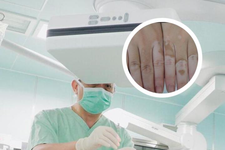 一块白头发就是白癜风么