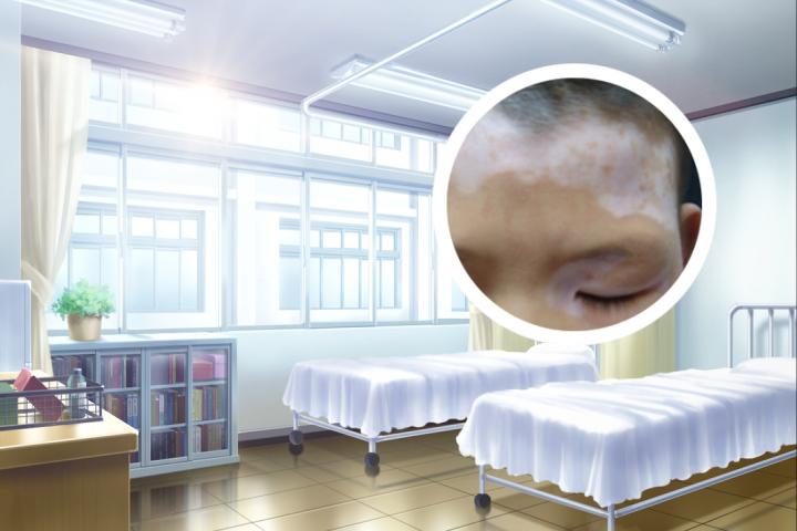 白癜风能闻消毒剂吗