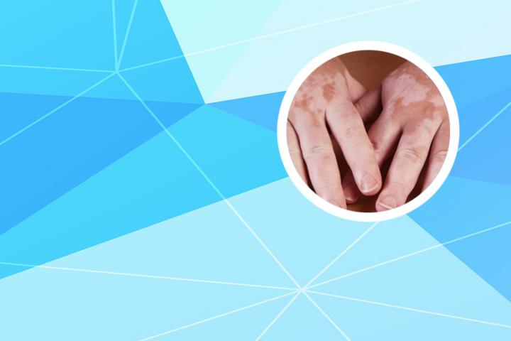 白癜风手拉手文案有趣视频