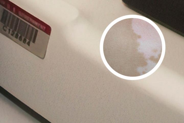 白癜风复方甘草片管用吗
