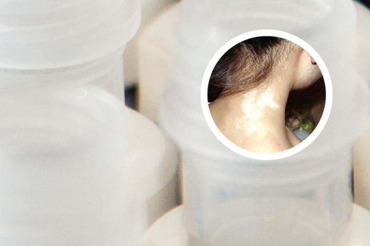 白癜风可治愈吗翘楚国丹
