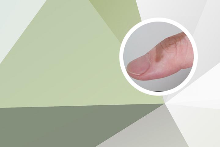 dha白癜风患者能用吗