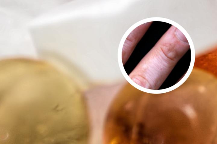 白癜风醋酸泼尼松片