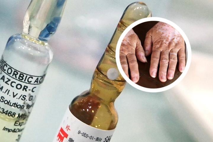 白癜风光照仪器图片价格