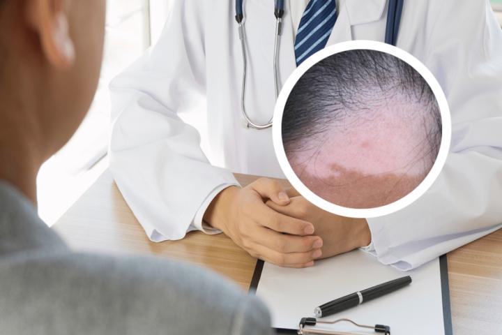 gxb白癜风成果转化