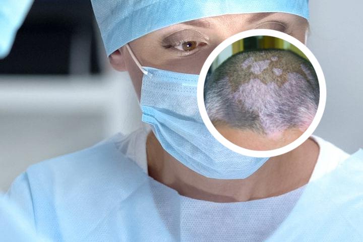 儿童白癜风可以吃白癜风丸吗
