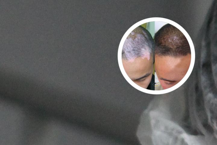 白癜风能吃沙糖桔吗