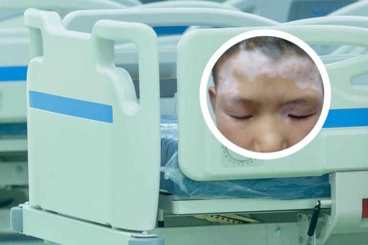 白癜风外用补骨脂多久能好