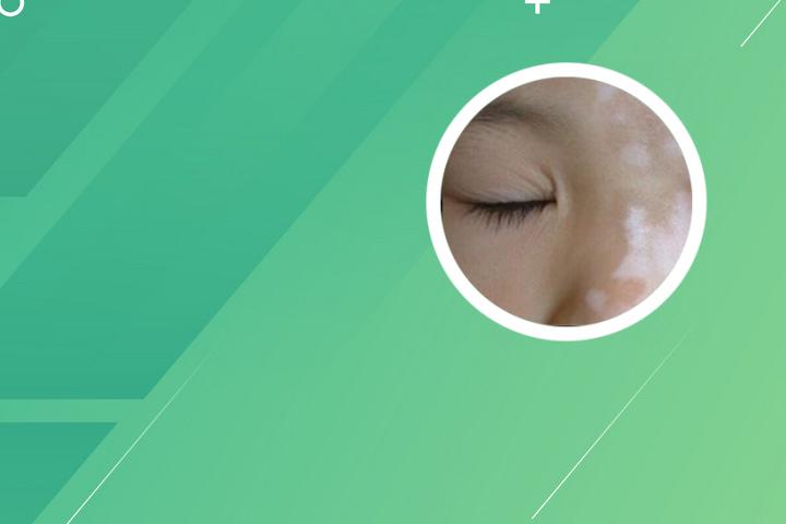 白癜风初期皮肤什么表现