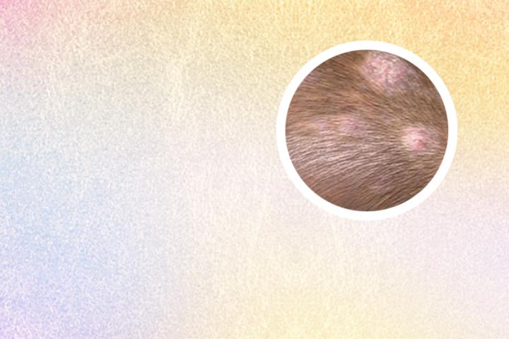 白癜风清愈油医药公司有卖的吗
