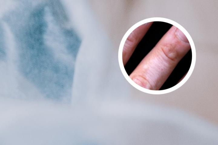 白癜风能吃火龙果吗