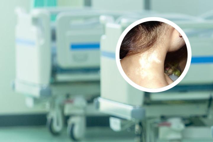白癜风很难彻底治愈