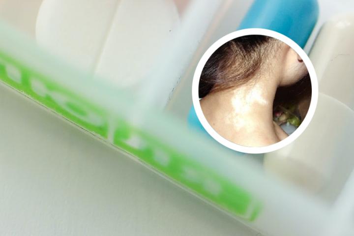 白癜风能治好吗请东莞博润