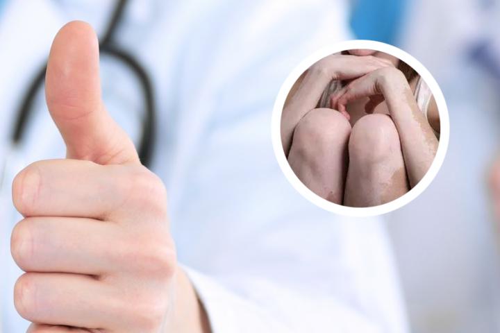白癜风穿衣注意什么