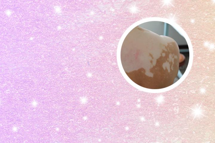 白癜风食物网名女仙气古风
