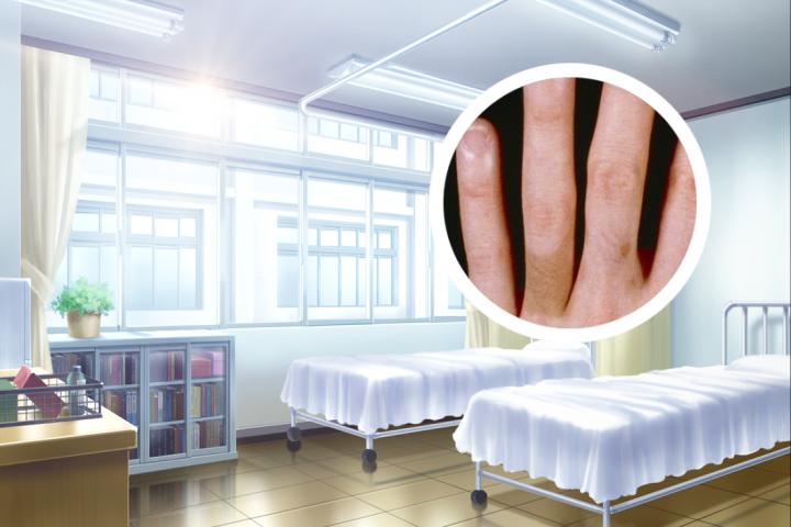 白癜风患处能看到毛孔吗