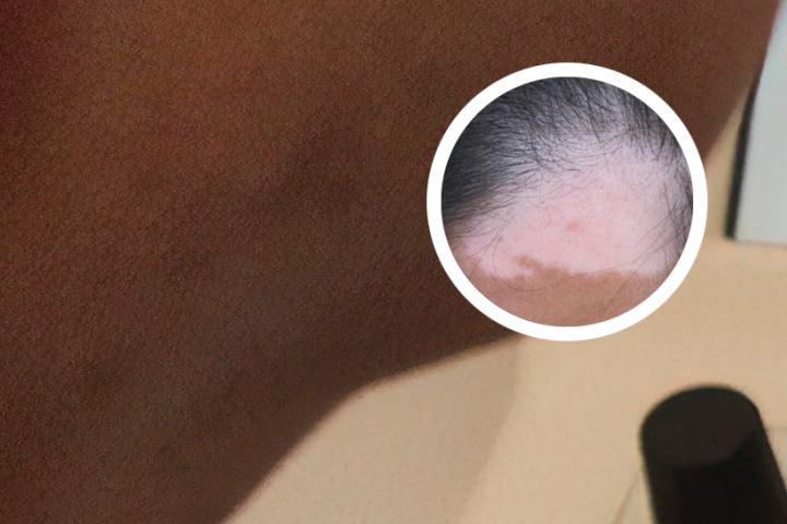 白癜风常识咖啡文案图片