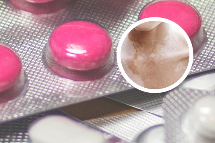 白癜风能治吗合肥华夏问诊