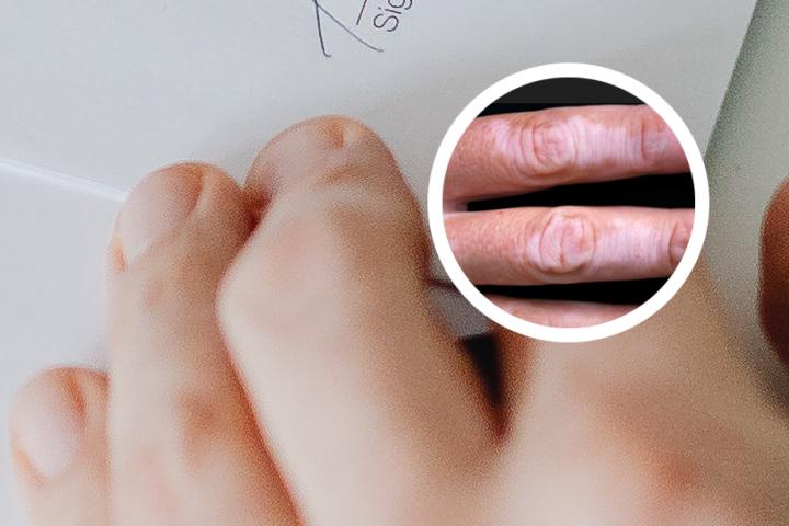 白癜风可以长期吃乌鸡吗