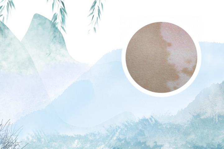 白癜风扩散期一定要忌口吗