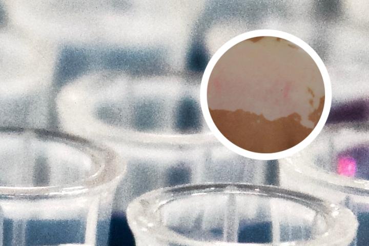白癜风最新治疗法