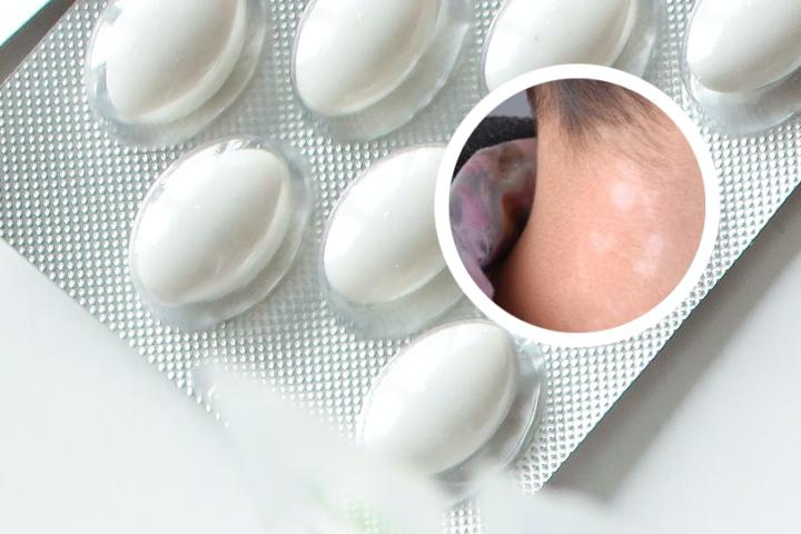白癜风患者能吃蓝莓吗