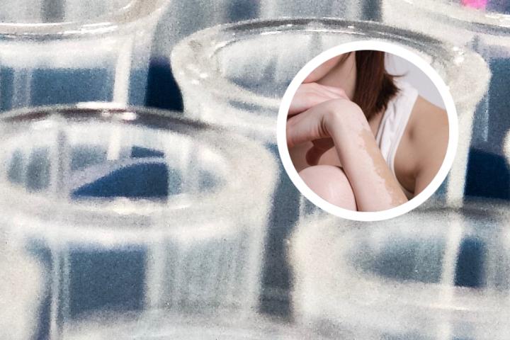 白癜风不敢吃绿色青菜吗