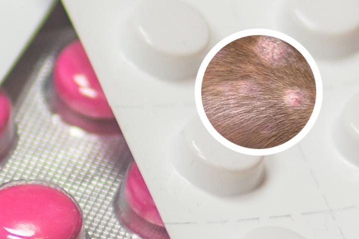 白癜风能坚持吃药吗
