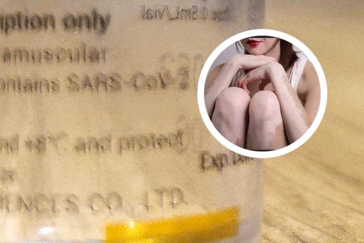 白癜风可以吃阿胶吗