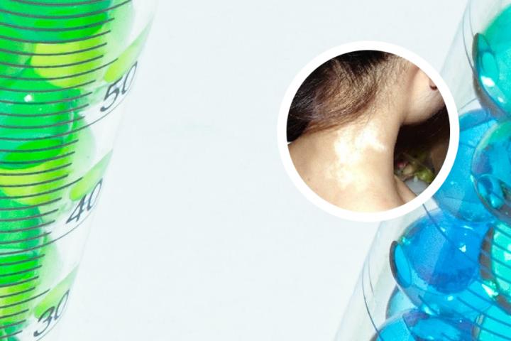 白癜风胶囊精华使用方法