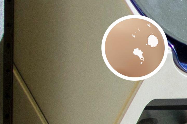 白癜风脸面的导演