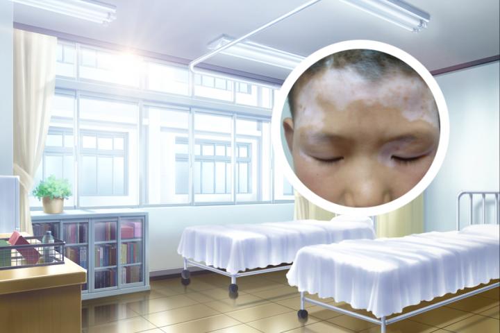 白癜风能吃干炒榛子吗