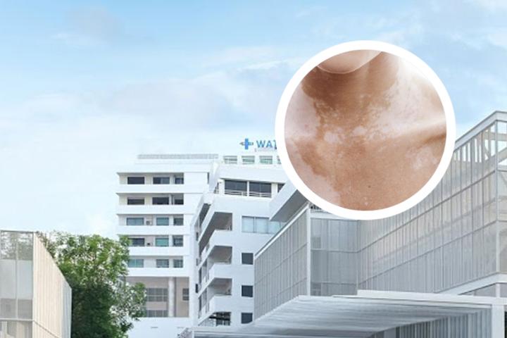 16岁得了白癜风