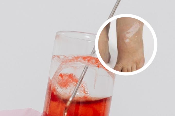白癜风适合吃胡萝卜吗