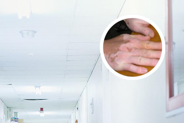白癜风可以用洗面奶么