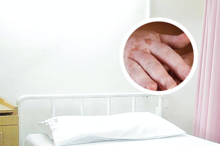 白癜风患者会有人歧视他们吗