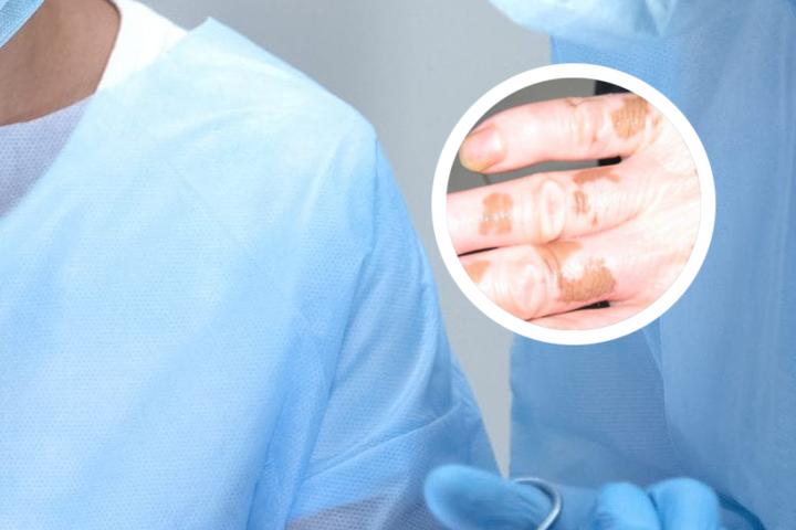 男人下身出现白斑就是白癜风吗