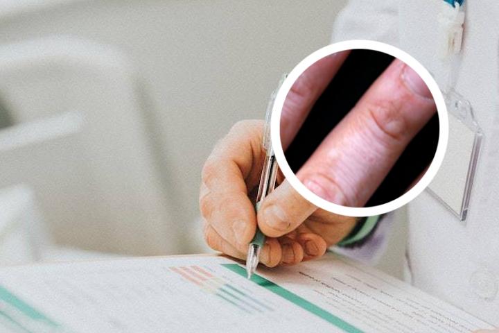白癜风患者可以吃柚子吗