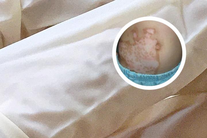 白癜风食物做法蛋糕