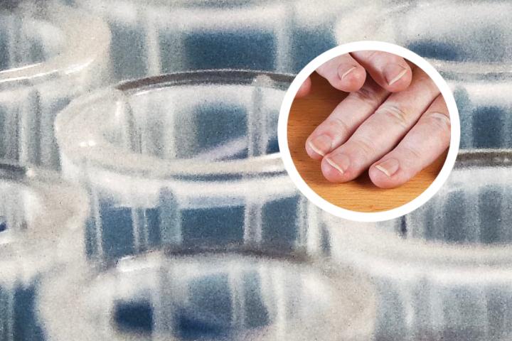 白癜风可以泡花茶喝吗